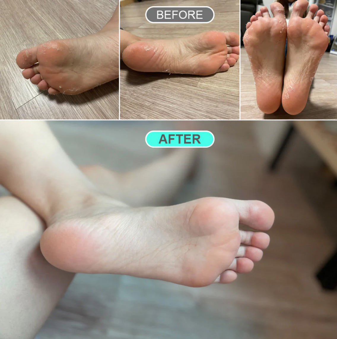 Premium Foot Peeling Pack Kocostar | Moshi Moshi Mart